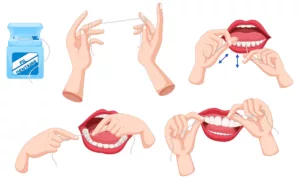 Illustration technique utilisation du fil dentaire